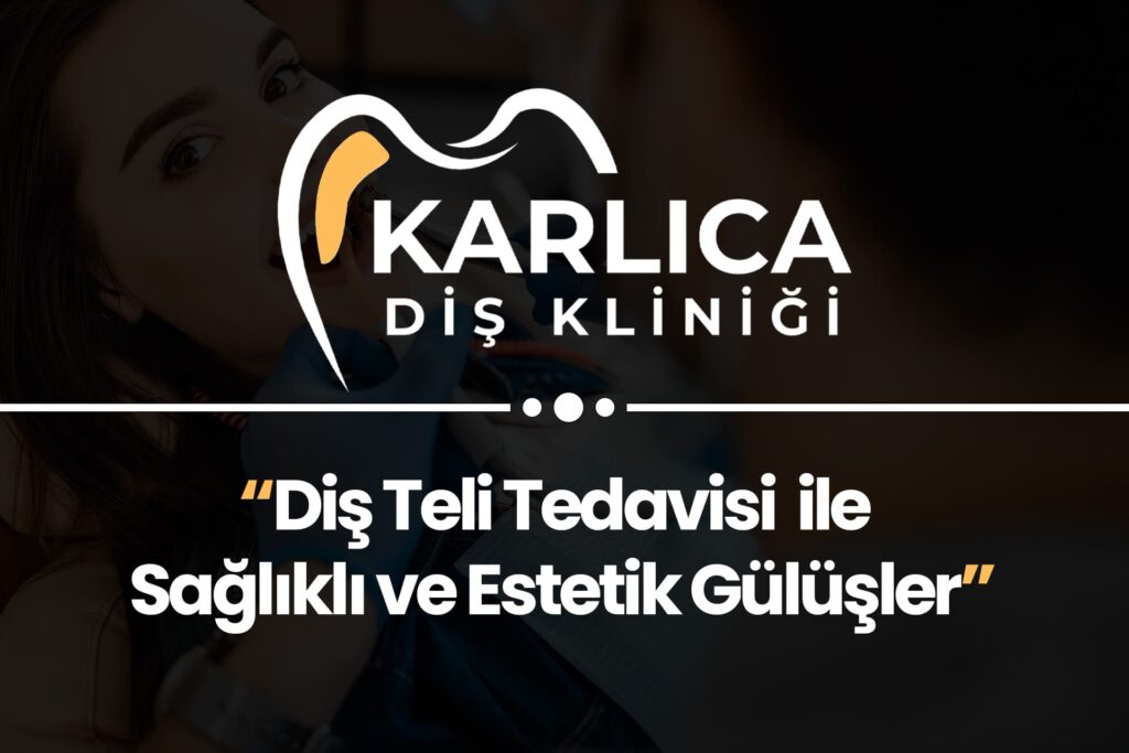 Karlıca Diş Kliniği – Diş Teli Tedavisi ile Sağlıklı ve Estetik Gülüşler