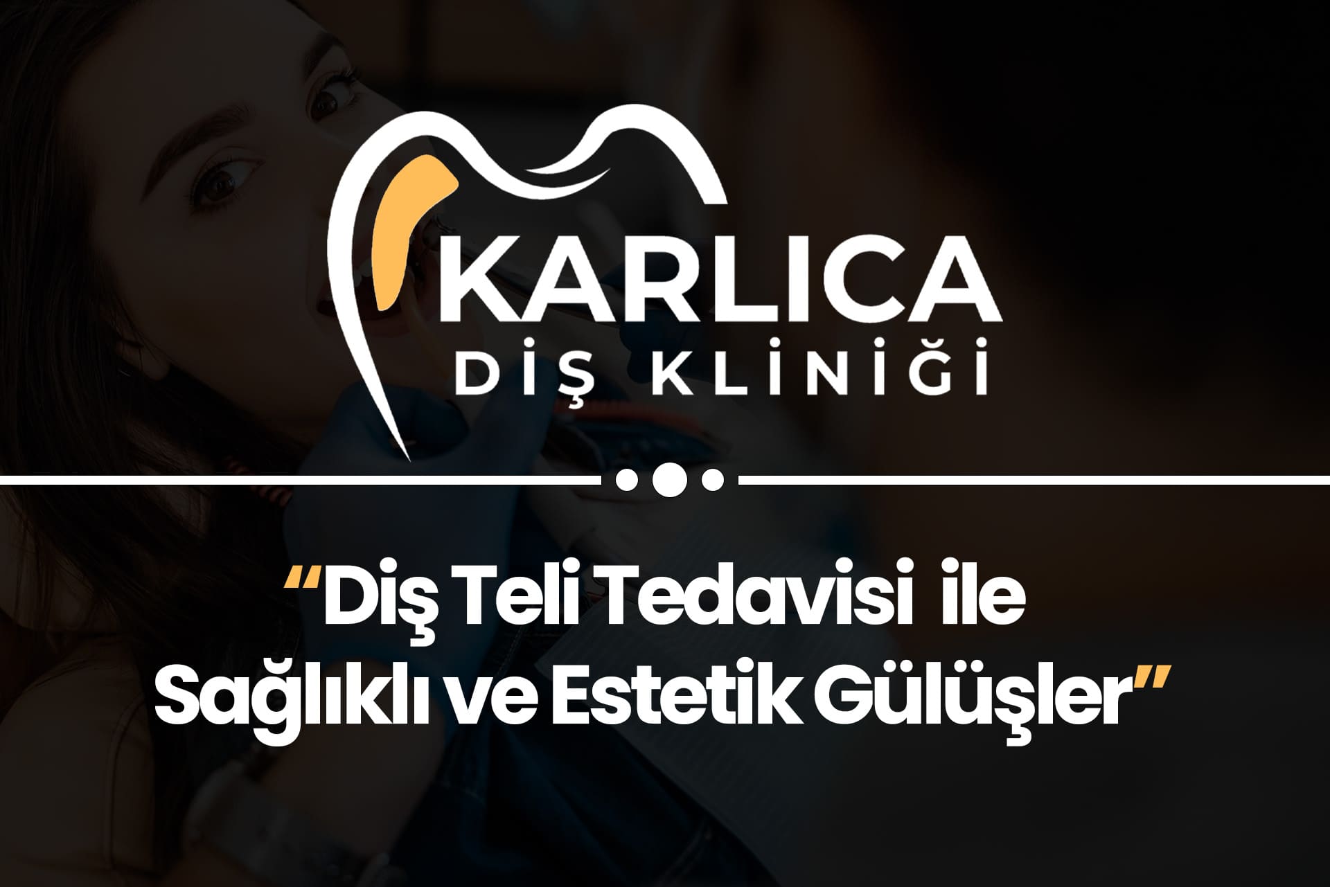 Karlıca Diş Kliniği – Diş Teli Tedavisi ile Sağlıklı ve Estetik Gülüşler